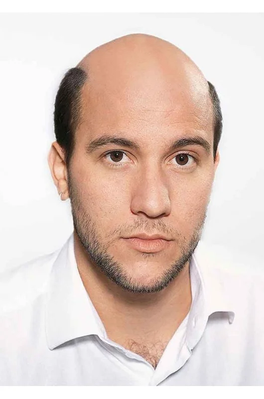 Monofilament βάση για άνετη εφαρμογή και φυσικό look.