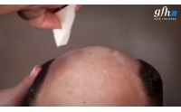 Werden Sie zum Experten für das Bonding Ihres Toupets!